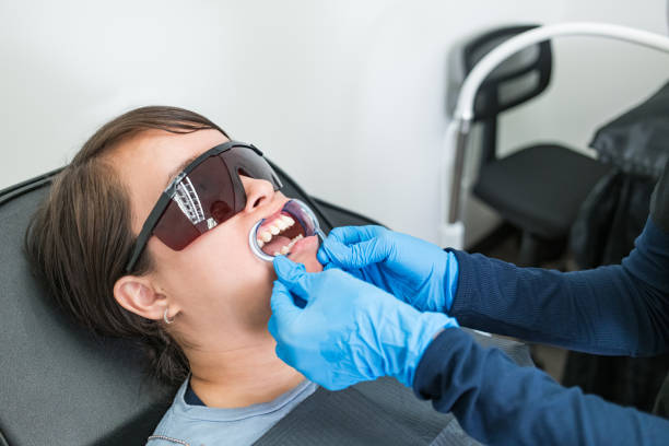 Best Knocked-Out Tooth (Avulsed Tooth) Treatment in Richfield, UT